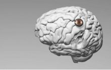 Neuralink Ілона Маска шукає кандидатів для вживлення нейрочипа у мозок